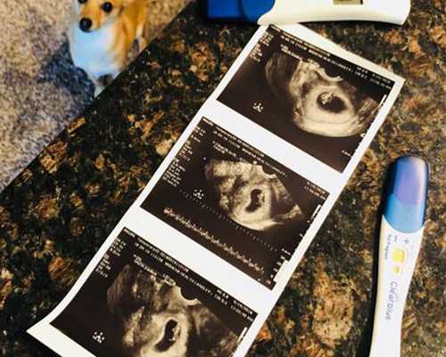 焦作做試管嬰兒，成功率到底怎么樣？